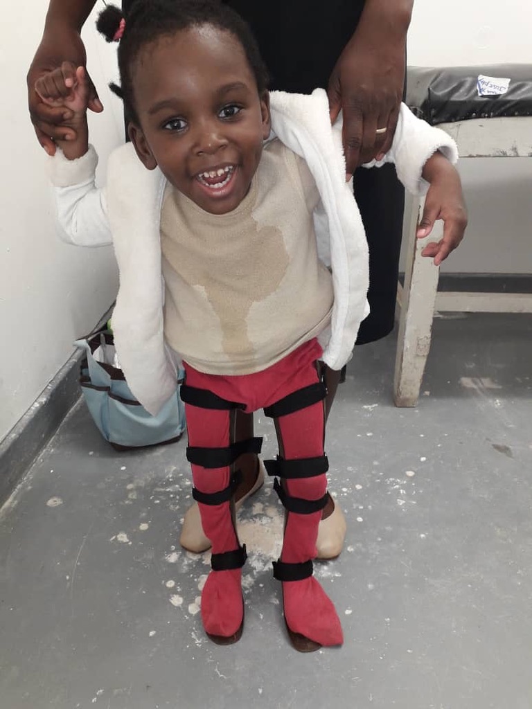 Mwayi With Her Orthoses