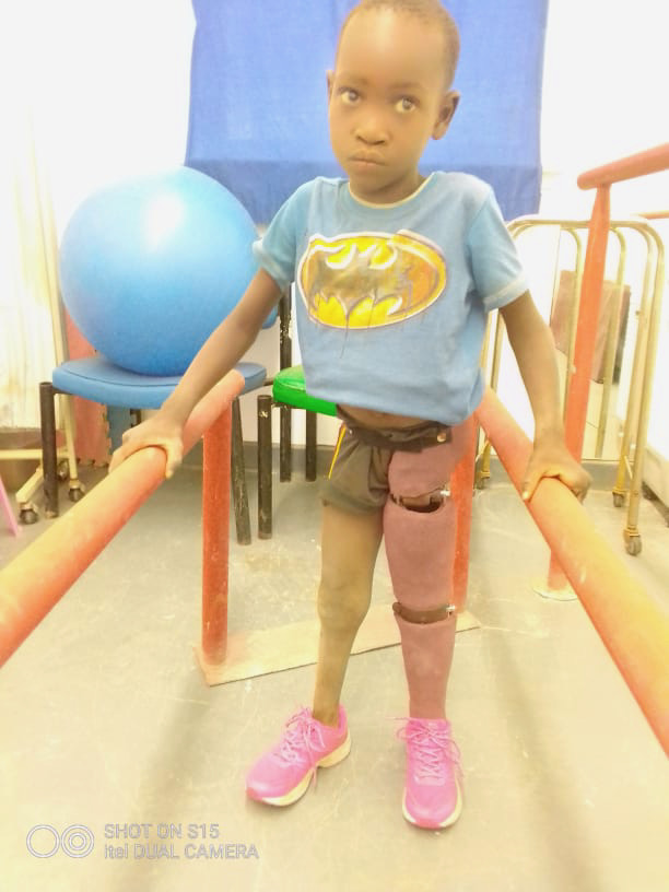 Sarah Watson with her new prosthesis
