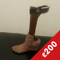 Symes prosthesis